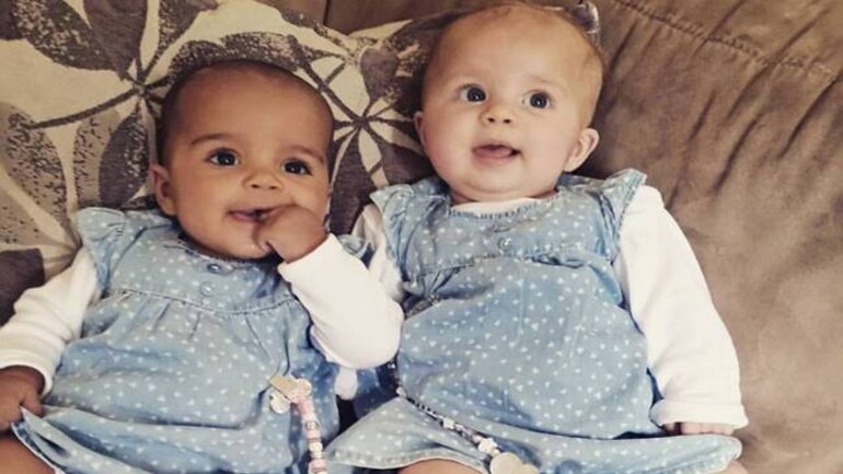 One Black One White These Twin Babies Were Born With Different Skin Colours Fyi News One Black One White These Twin Babies Were Born With Different Skin Colours Fyi News