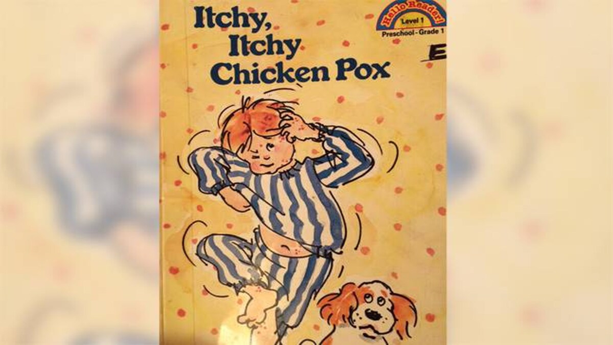 My Kids Just Recovered From Chicken Pox And It Wasn T Half As Bad As It Sounds Lifestyle News