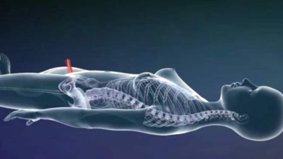 This Video Explains How A Penis Is Turned Into A Vagina During A Gender Reassignment Surgery Lifestyle News