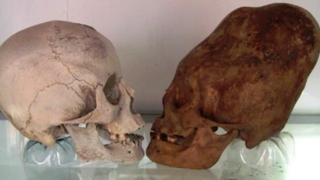 Are Ancient Peruvians Having Long Skulls Really Aliens Education Today News