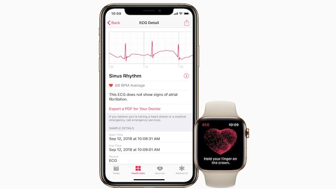 Watch that shows heart discount rhythm
