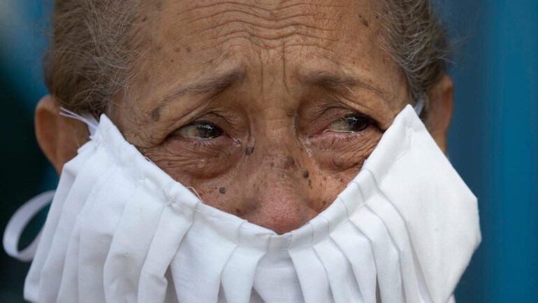 Coronavirus Infection Now Add Pinkeye To List Of Atypical Symptoms Of Covid 19 Coronavirus Outbreak News