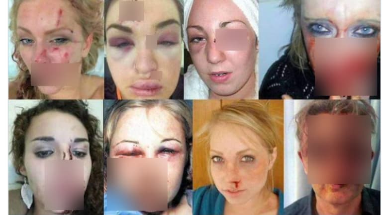 Fact Check These Women Were Not Injured In The Sweden Riots Fact Check News