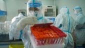 Explained: How accurate is the anal swab Covid-19 test rolled out in China anal swab Covid-19 test, what is anal swab Covid-19 test, anal swab Covid-19 test china