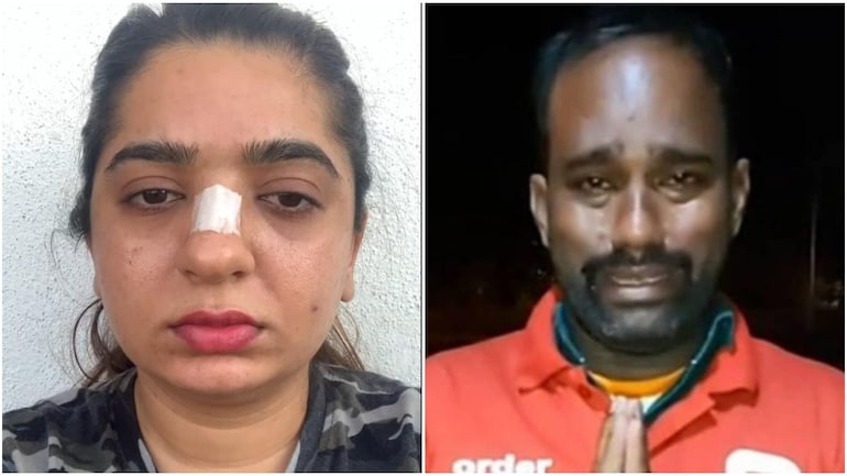 Bengaluru: Influencer Hitesha Chandranee booked for assaulting Zomato worker Kamaraj Bengaluru: Influencer Hitesha Chandranee booked for assaulting Zomato worker Kamaraj
