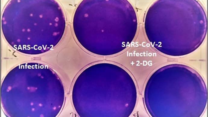Easy to produce, easier to consume: DRDO's 2-DG drug for treatment of Covid patients | FAQs