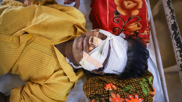 Black Fungus Does India Have A Plan To Combat The Rising Threat Coronavirus Outbreak News Black Fungus Does India Have A Plan To Combat The Rising Threat Coronavirus Outbreak News
