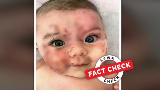 Fact Check: This girl was not 'injured' in Israeli airstrikes on Gaza