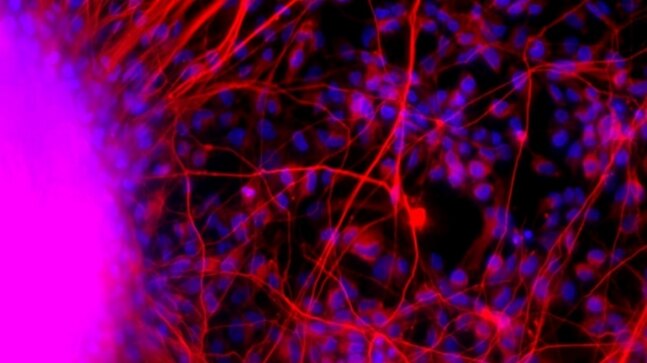 Indian researcher develops human brain cells in a dish to study complex neurological disorders - Vimarsana News