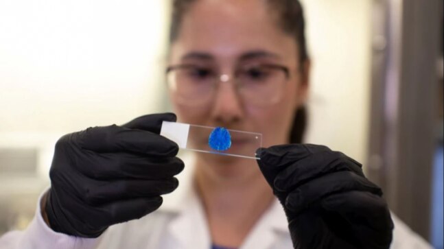 Cells from cancer patient used in 3D printed tumours to test treatments - Vimarsana News