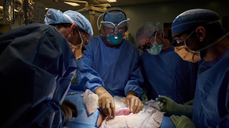Scientists attach pig's kidney to human body in breakthrough transplant - SCIENCE News
