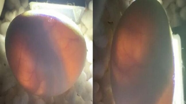Know the inside of 'alien-like' eggs that contain the most venomous snakes