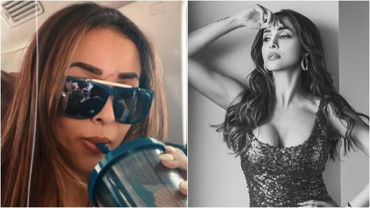 Malaika Arora shares first pic of her scar after car accident. See here