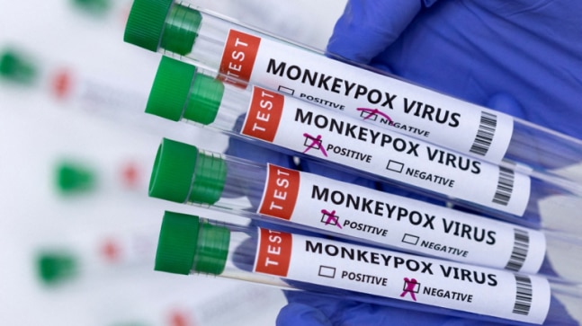 How does the monkeypox virus spread? - Vimarsana News
