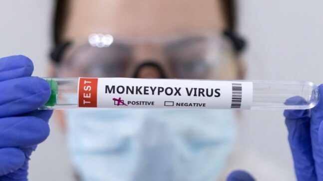 Monkeypox won't turn into pandemic, but many unknown: WHO - Vimarsana News