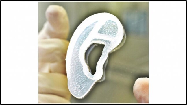 Woman gets first 3D-printed ear made from her own tissue - Vimarsana News