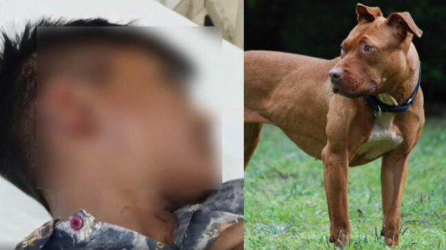 13-year-old boy left with mangled ear after pitbull attack in Punjab's Gurdaspur - Vimarsana News