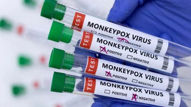 Nothing ridiculous, says WHO as public wants to rename monkeypox as Trump-22 - Vimarsana News