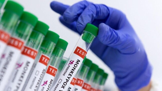 China reports its first monkeypox case in person who arrived from abroad