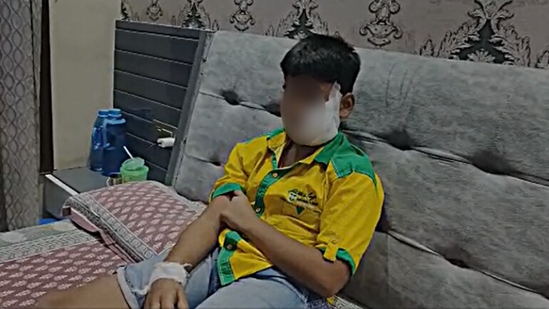 An 11-year-old boy sustained grave injuries after being bitten by a pet pibull dog in Ghaziabad An 11-year-old boy sustained grave injuries after being bitten by a pet pibull dog in Ghaziabad