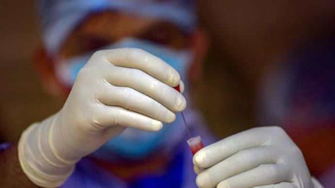 भारत में पिछले 24 घंटे मे COVID-19 के 7,633 नए मामले आए सामने- 7,633 new cases of COVID-19 were reported in India in the last 24 hours