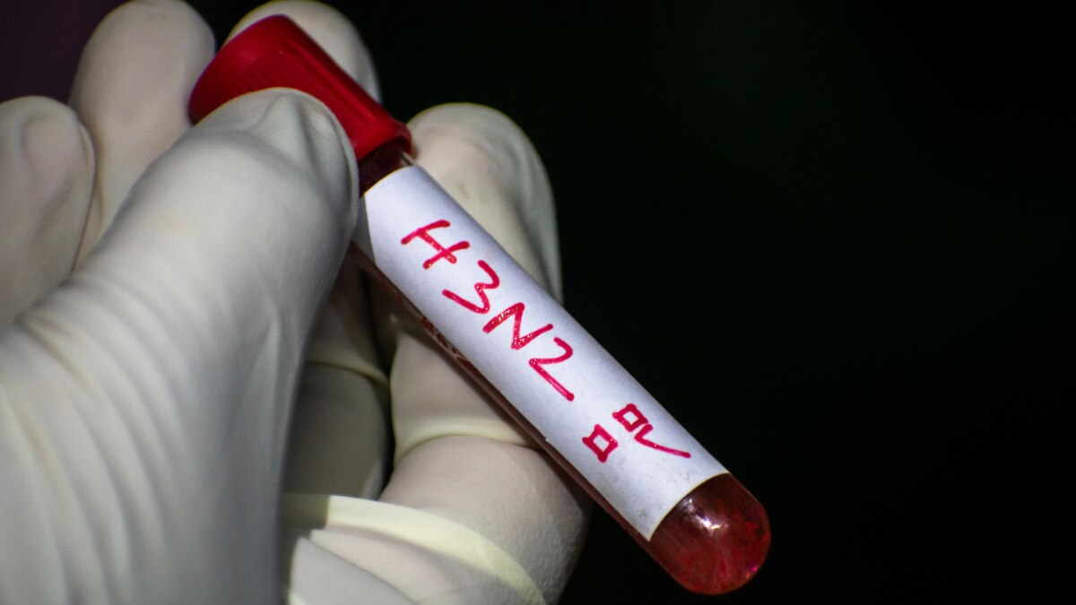 जमशेदपुर में H3N2 के दो संक्रमित मरीज मिले- Two infected patients of H3N2 found in Jamshedpur