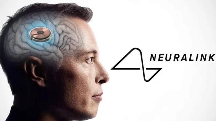 elon-musks-neuralink-213229105-16x9.jpg