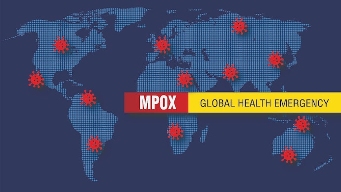 We can and must tackle amphibians together: WHO official. (Photo: Getty Images) Ampox a global health emergency