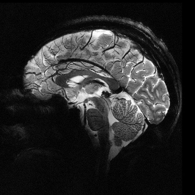 human-brain-125413289-1x1.jpg?