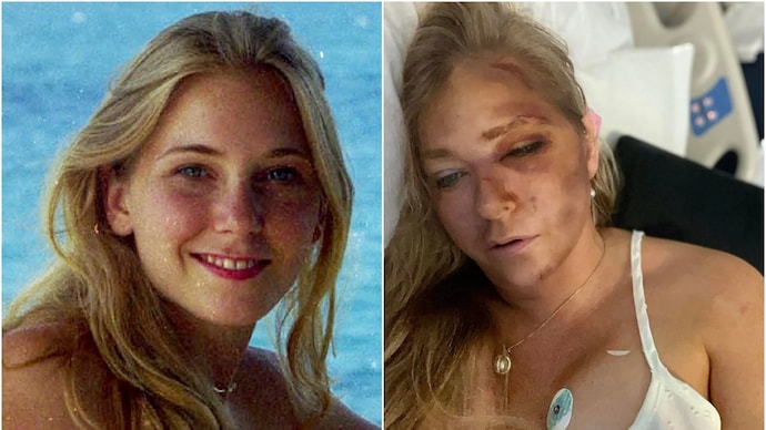 Virginia Giuffre, Prince Andrew accuser, reveals critical injuries in car crash: 4 days to live - India Today