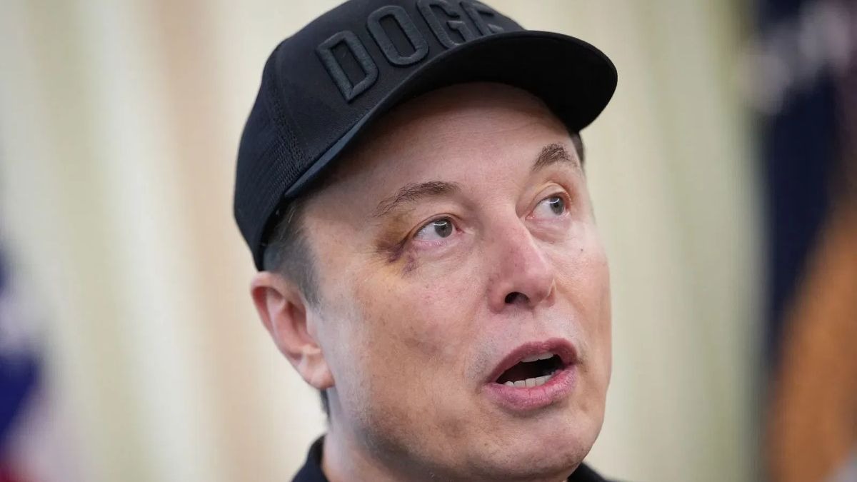 Elon Musk appears in Oval Office with black eye, blames playful punch from son - India Today