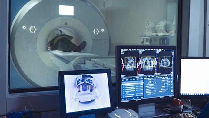 The process uses sound waves to focus on a specific part of the brain. (Photo: Getty Image) The process uses sound waves to focus on a specific part of the brain. (Photo: Getty Image)