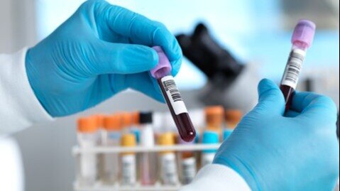 India's diagnostic labs face quality crisis amid low accreditation