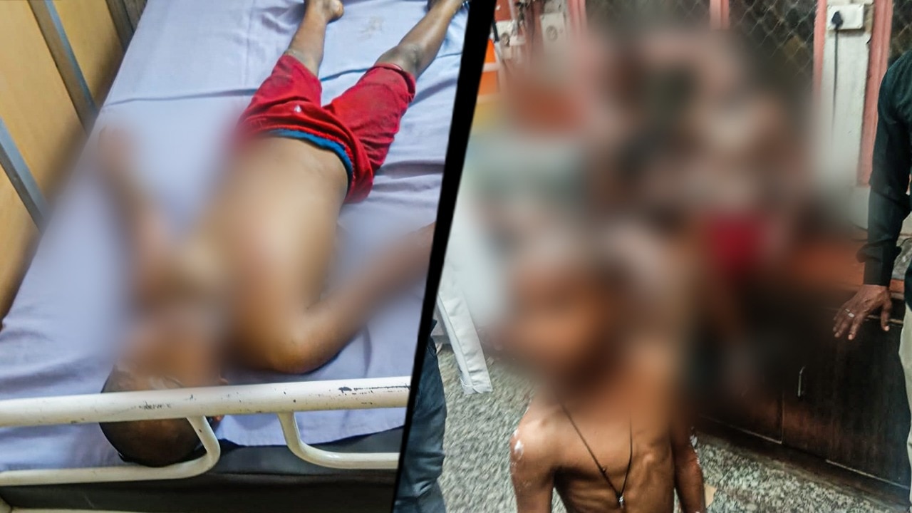 Man pours boiling oil on five children in Unnao, two battling for life