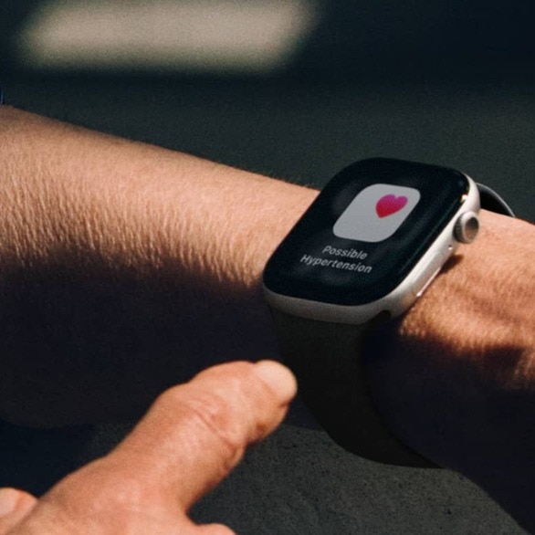 Apple Stores will soon start to offer on-site software recovery for Apple Watch