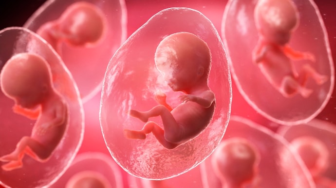 Ending a pregnancy at seven months typically involves inducing labour rather than performing a standard abortion. (Photo: Getty Images) Cloning, conceptual illustration