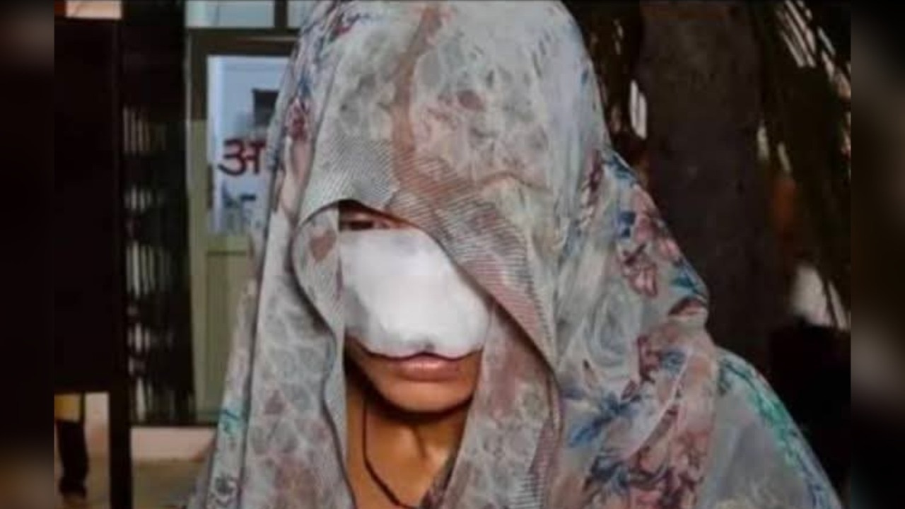 Husband bites woman's nose, cheek; leaves her with 10 stitches on face