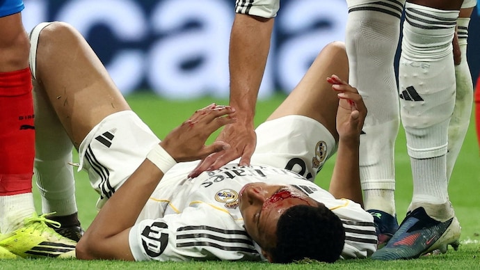A bloodied Kylian Mabppe lies on the ground (Photo Reuters) Kylian Mbappe