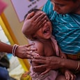 Major measles outbreak in Bangladesh. Major measles outbreak in Bangladesh.