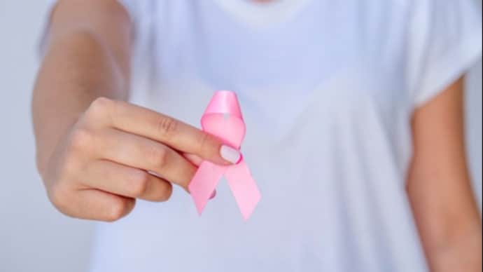 The study noted that patients diagnosed at a local stage had a 4.4 times greater chance of five-year survival compared to those with distant-stage cancer.