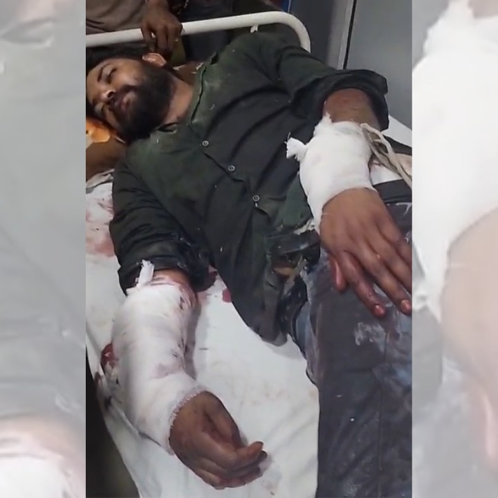 Confectioner tied up, hands mutilated with grinder over wedding dues in Delhi