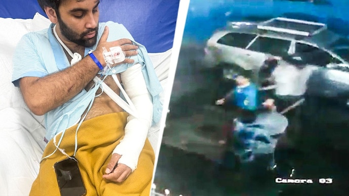 The passenger sustained hand injuries in the alleged attack by Yusuf Pathan’s in-laws. The passenger sustained hand injuries in the alleged attack by Yusuf Pathan’s in-laws.