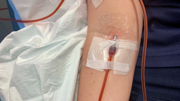 An IV infusion of ferritin. (Photo: Getty Images) An IV infusion of ferritin.