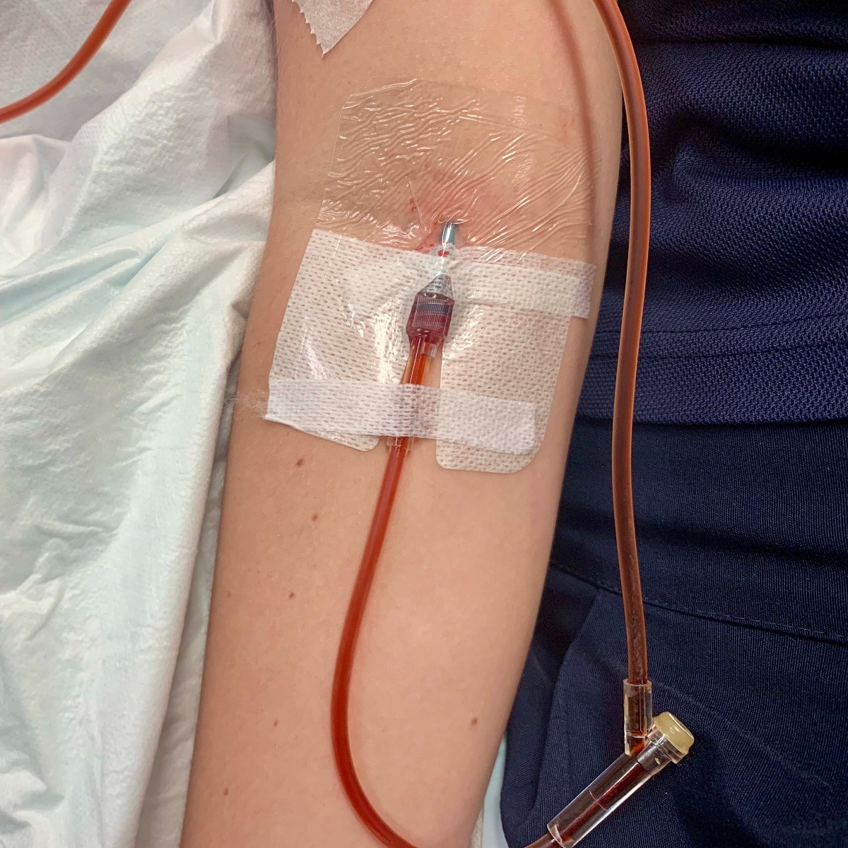 Beyond red iron tablet: Hospitals try IV therapy for anaemic pregnant women