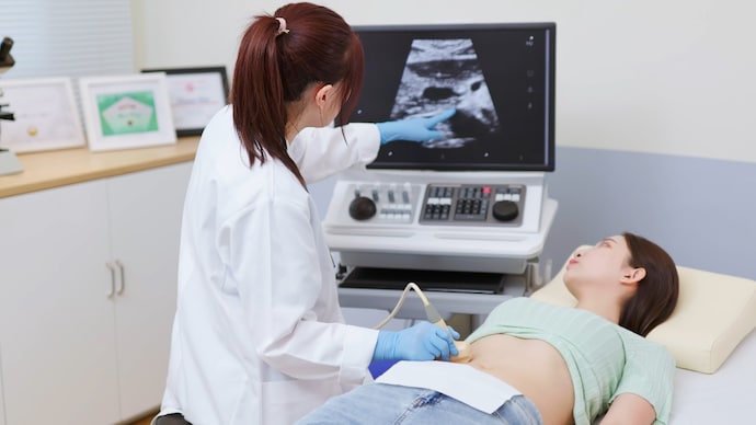 Doctors say the term "polycystic ovary syndrome" created confusion because many women with the condition do not actually have ovarian cysts. (Photo: Getty Images) asian doctor using ultrasound scanner performing examination of belly for her patient - feminine health medical concept