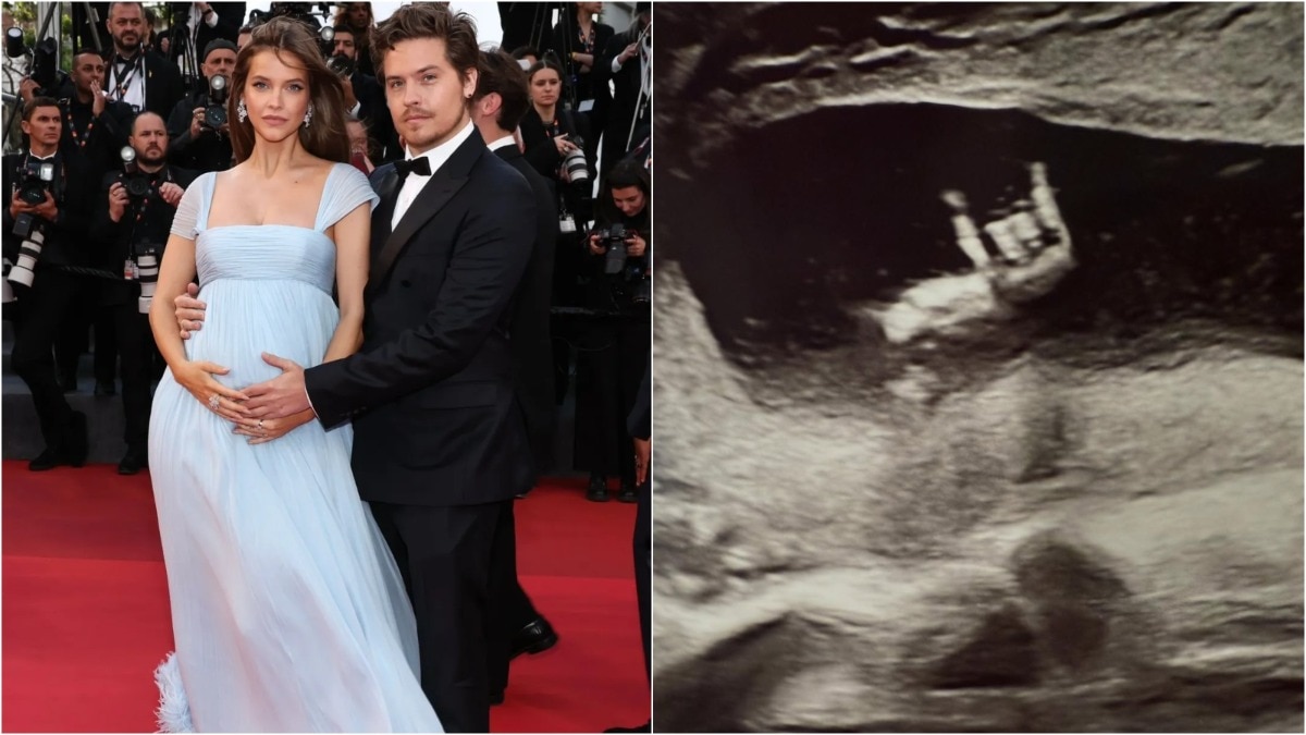 Barbara Palvin and Dylan Sprouse at Cannes, and (right) a Sonogram image they posted (Credit: Instagram/@darbaradaily, @realbarbarapalvin) Barbara Palvin, Dylan Sprouse