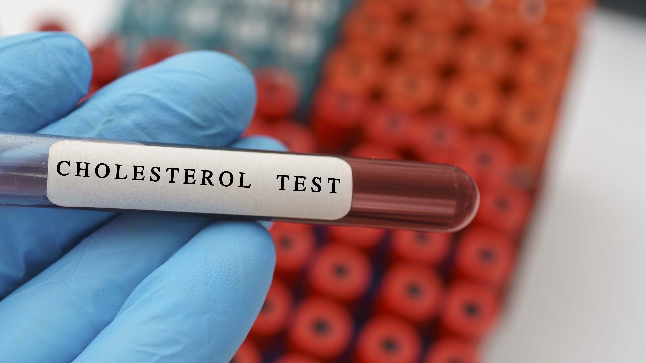 When should you check your cholesterol? Doctor explains by age
