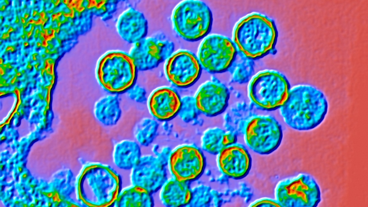 Hantavirus myths busted: What people are getting wrong about the virus