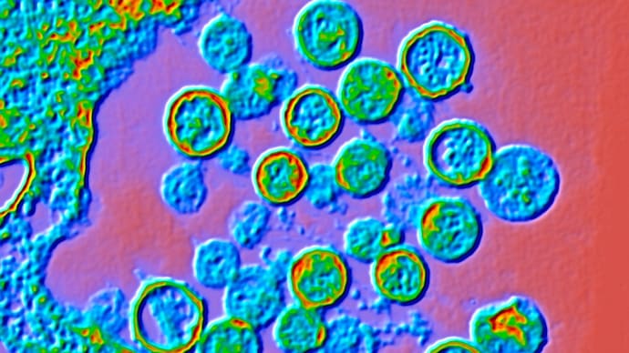 Color enhanced transmission electron micrograph (TEM) of Hantavirus particles. (Photo: Getty Images) Color enhanced transmission electron micrograph (TEM) of Hantavirus particles.