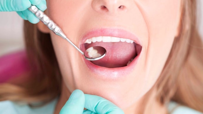 Inflammation in the mouth does not just stay limited to the gums or teeth. Instead, it spreads immune signals throughout the body and reaches the ovaries. (Photo: Getty Images) Female patient with open mouth receiving dental inspection at dentist's office